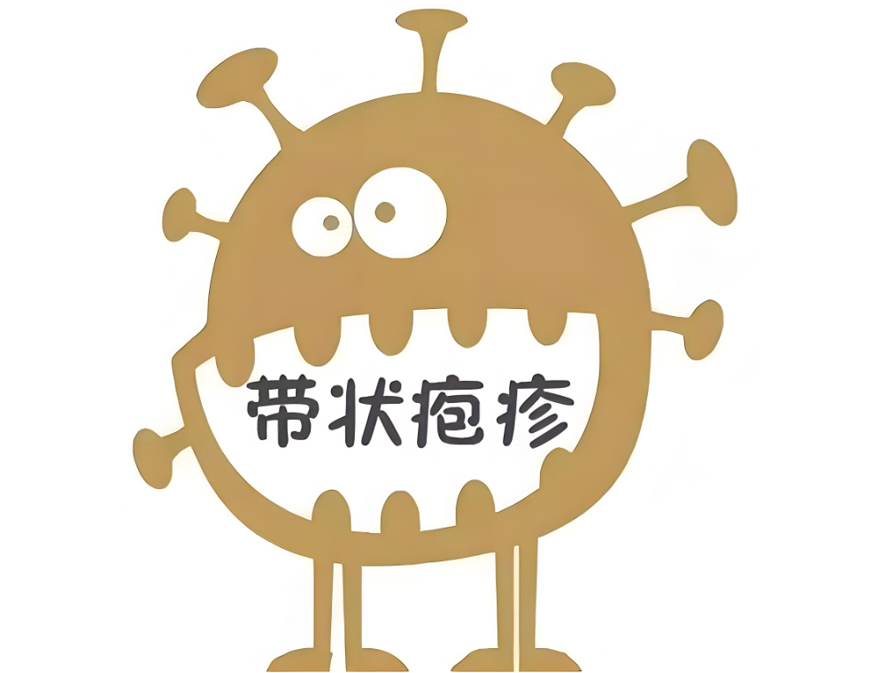 带状疱疹有哪些特点,它的成因有哪些?